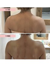 ケーアンド(K&)/ 《オーダーメイド施術》