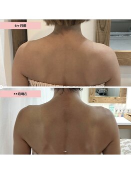 ケーアンド(K&)/ 《オーダーメイド施術》