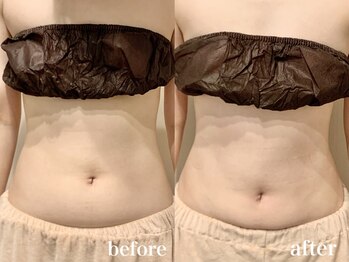 ティアモ(Ti Amo)/Before/After