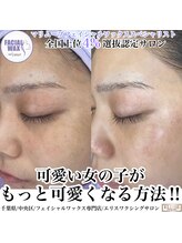 エリス(ELISSE)/フェイシャルワックス