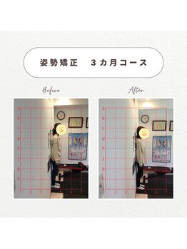 心斎橋長堀フェムテック整骨院/姿勢矯正整体　3カ月コース