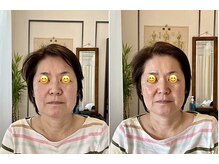 パーソナルケア Personal care/整顔×EMS で上がる・引き締まる