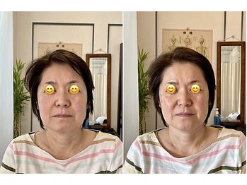 パーソナルケア Personal care/整顔×EMS で上がる・引き締まる