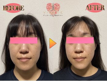 ヴィオーデ美容整体サロン 大宮店/小顔、リンパ、ヘッドスパ、整体
