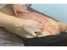 エミール(EMIIR)