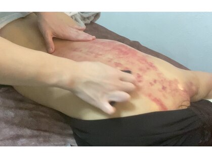 エミール(EMIIR)の写真