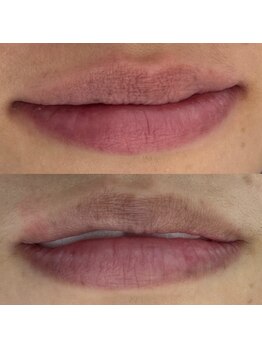 ベル 調布(Belle)/ローマピンク | 唇