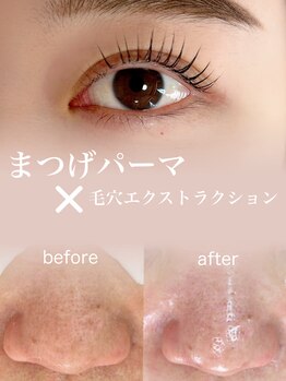 アモア(amoa)/まつげパーマ×毛穴ケア