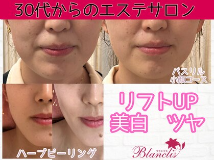 ブランリス 京都店(Blanclis)の写真