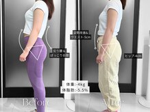 リフ(RIF)/姿勢改善で反り腰&ぽっこり改善