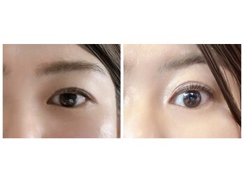 ルキア(LUKIA)/小顔【目元集中】施術１回