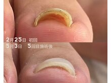 スリーナイン(3Nine)/