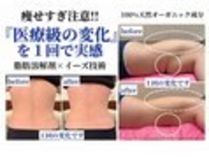 クリニカルエステ イーズ イオンモール筑紫野店の写真