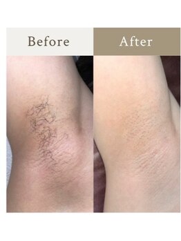 フローラル ビューティー(Floral-Beauty)の写真/「都度払いOK♪コース契約に縛られず、自分のペースで通える脱毛サロン」