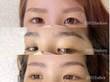 ベル(Bell)/ハリウッドブロウリフト