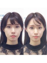 オズ六本木/小顔矯正ご新規様大募集！