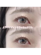 レディエント(Radiant)/上下パリジェンヌラッシュリフト