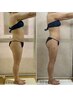 【痩身専用】世界特許インディバ温熱とインナーケアで美ライン実現への120分