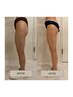 NO.2◇温活×痩身マシンで美脚&くびれ◎/下半身太り/むくみ撃退！44000円→