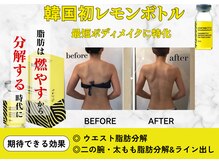 フレアージュ/レモンボトルボディビフォアフ