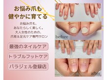 ナユネイル(na_yu.nail)