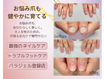 ナユネイル(na_yu.nail)