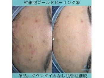 リメイク 広尾(REMAKE)/