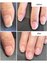 ケアプラス(care plus)/ハンドネイルケア