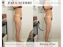 リノア 柏(Lino'a)/ポールシェリー痩身/美脚 小尻