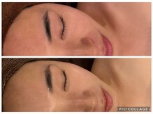 イディアル(IDE'AL)の雰囲気（【毛穴・赤み・ニキビ・シミ・シワ・たるみ】の改善へ◎ピール＊）