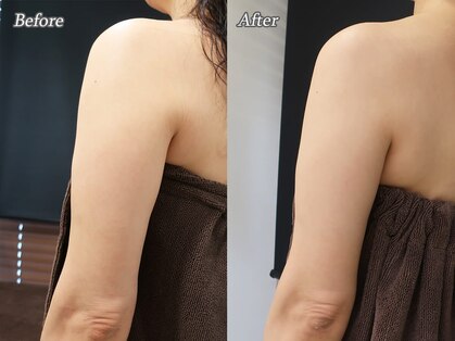ビースリム(Be Slim)の写真