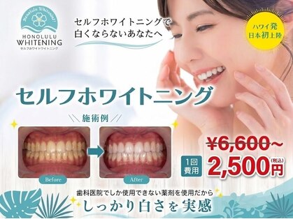 ボーテ 北浜の写真