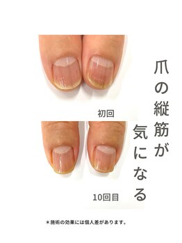 最強ネイルケア