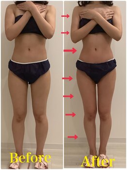 スペチアーレ 夙川/ハイパーナイフで代謝UP♪