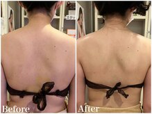 サロンドフェイス(Salon de Faith)/【ブライダル】3回施術♪