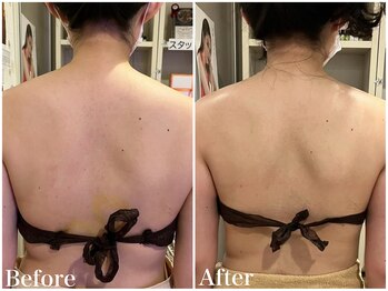 サロンドフェイス(Salon de Faith)/【ブライダル】3回施術♪