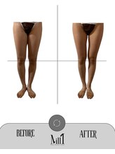 ミル 恵比寿店(Mill)/《痩身》