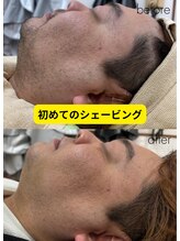 ルポ(Repos)/メンズエステシェービング