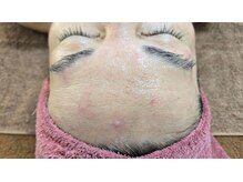 クレビア(CREBIA)/【シミ・シミケア専門店】沖縄県