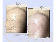 サロン オキーフ(Salon O'keeffe)の雰囲気(特に毛穴◎.たるみ,くすみケアもお任せください♪)