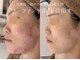 エービューティーサロン 松山店(A BEAUTY SALON.)の写真