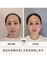 ふらっとエステ/本来の美しさを引き出します