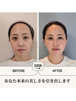 ふらっとエステ/本来の美しさを引き出します