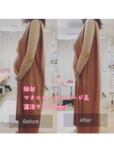 キアラ(Chiara)/マタニティ・ビフォーアフター