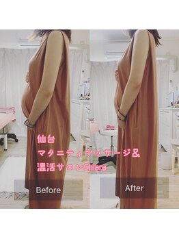 キアラ(Chiara)/マタニティ・ビフォーアフター