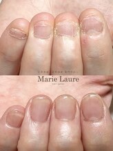 マリーロール 梅田店(Marie Laure)/自爪育成/深爪矯正/ネイルケア