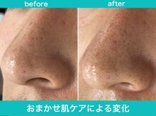 ミスターアンクール 鹿児島(Mr.uncoeur)/おまかせ肌ケア