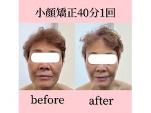 美肌脱毛エステサロン ベール 昭島店の雰囲気（大人気のリフティング小顔矯正も初回￥5500！）