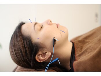 ハリファ鍼灸院 横浜関内院(HariFa鍼灸院)/美容鍼