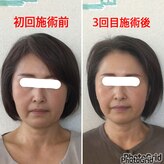 小顔矯正サロン ぷてぃらっく